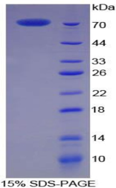 Pig Recombinant Creatine Kinase, Muscle (CKM)