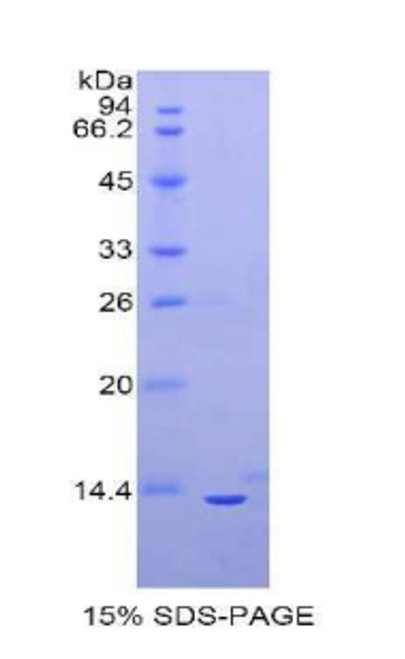 Mouse Recombinant Oncostatin M (OSM) Mouse Recombinant Oncostatin M (OSM)