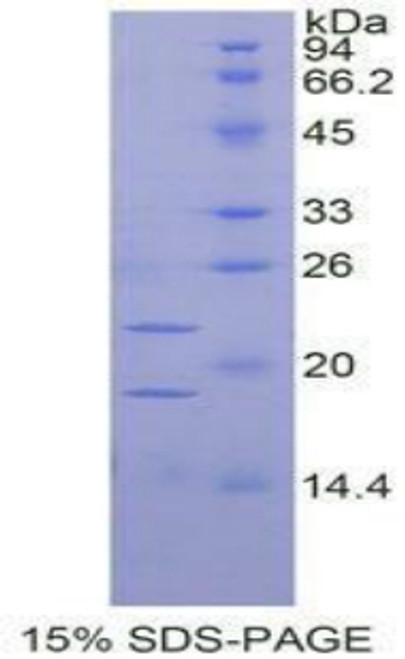 Rat Recombinant Placenta Growth Factor (PLGF)