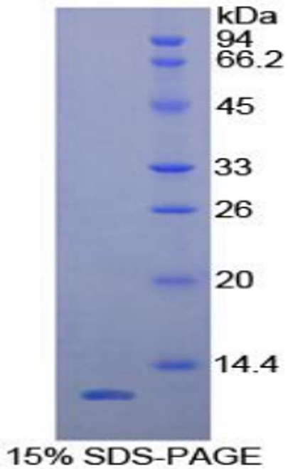 Human Recombinant Regulated On Activation In Normal T-Cell Expressed And Secreted (RANTES)