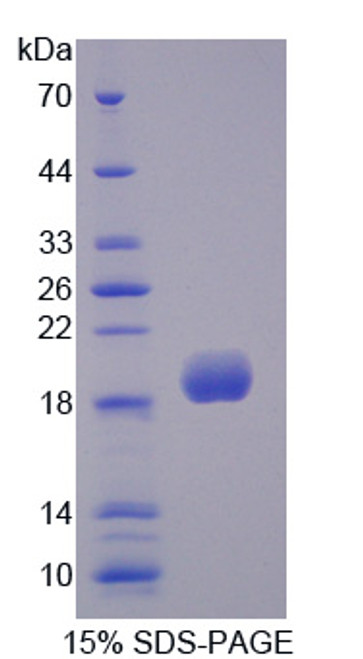 Rabbit Recombinant Superoxide Dismutase 3, Extracellular (SOD3)