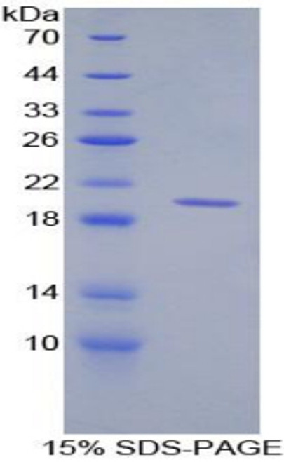 Human Recombinant Cluster Of Differentiation 30 Ligand (CD30L)