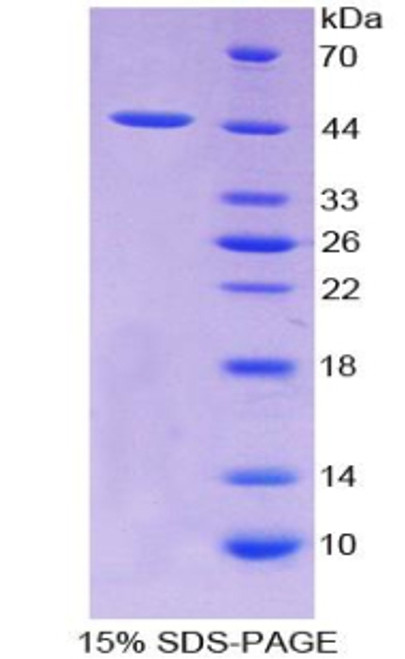 Sheep Recombinant Transforming Growth Factor Beta 1 (TGFb1)