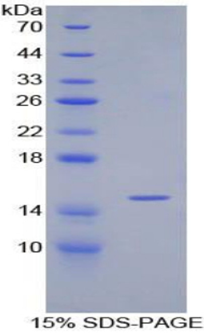 Rabbit Recombinant Transforming Growth Factor Beta 1 (TGFb1)