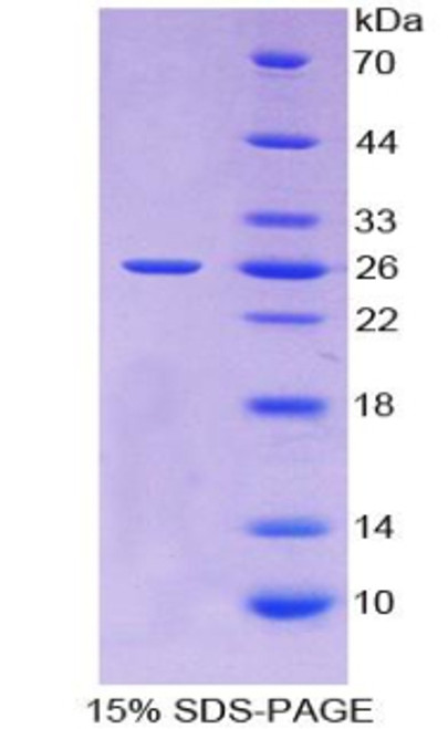 Human Recombinant Tissue Inhibitors Of Metalloproteinase 3 (TIMP3)