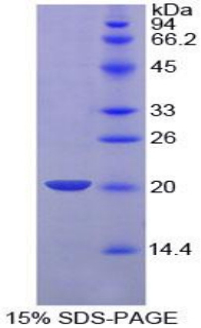 Pig Recombinant Plasminogen Activator, Urokinase (uPA)