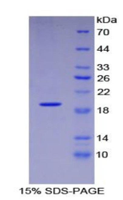 Human Recombinant Vascular Endothelial Growth Factor A (VEGFA)