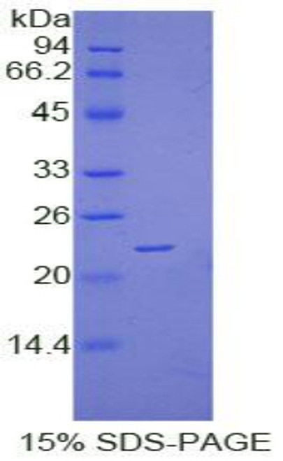 Human Recombinant Vascular Endothelial Growth Factor B (VEGFB)