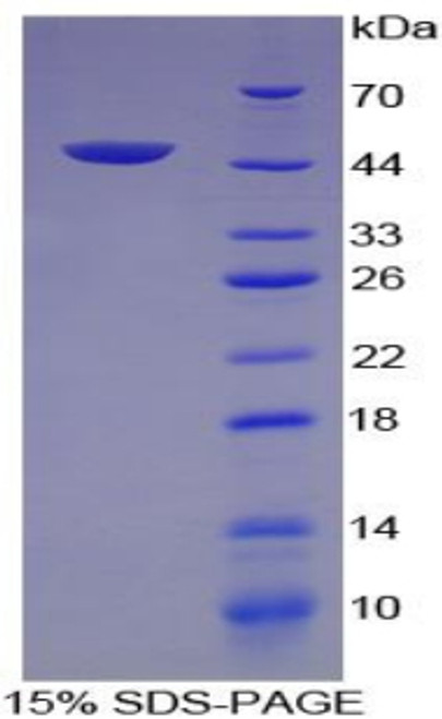 Human Recombinant Vascular Endothelial Growth Factor C (VEGFC)