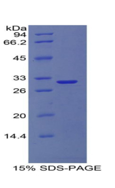 Human Recombinant Collagen Type IV Alpha 1 (COL4a1)