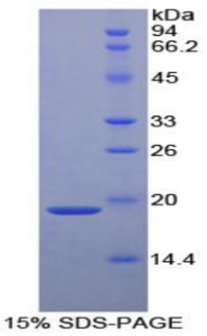 Human Recombinant Alpha-2-Plasmin Inhibitor (a2PI)