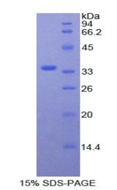 Recombinant Staphylococcal Protein A (SPA)