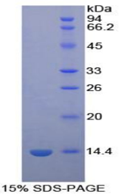 Human Recombinant Platelet Factor 4 (PF4)