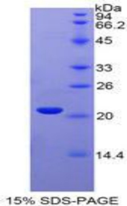 Human Recombinant Interferon Alpha 4 (IFNa4)