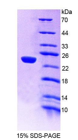 Mouse Recombinant Glucosidase Alpha, Acid (GaA)