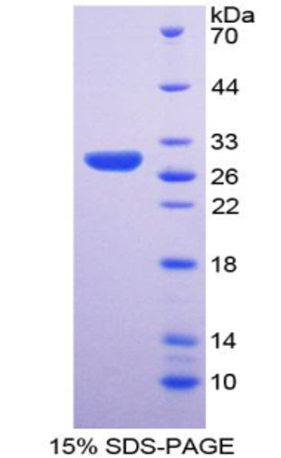 Human Recombinant Ribonuclease P (RNASEP)