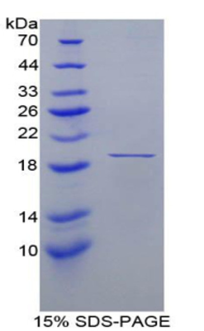 Human Recombinant Fatty Acid Binding Protein 9, Testis (FABP9)