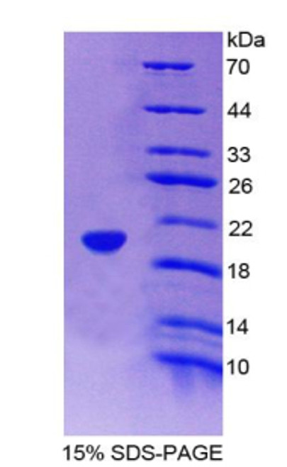 Rat Recombinant Fatty Acid Binding Protein 9, Testis (FABP9)