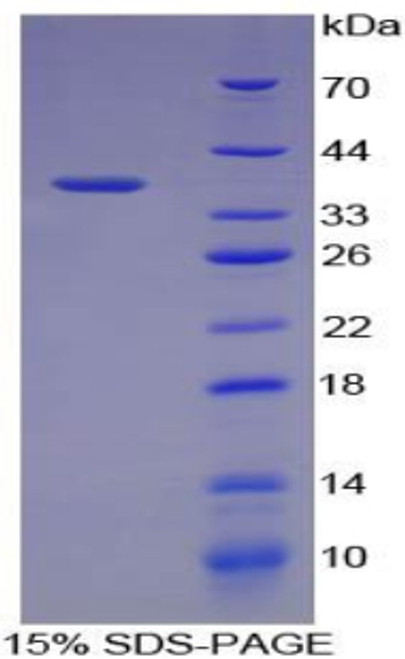 Pig Recombinant Alanine Aminotransferase (ALT)