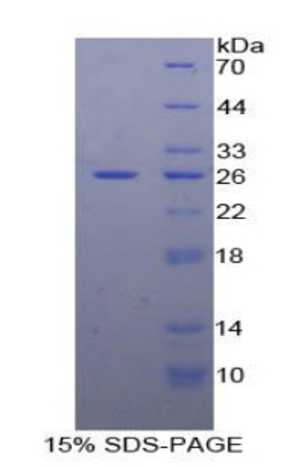Pig Recombinant Triggering Receptor Expressed On Myeloid Cells 1 (TREM1)