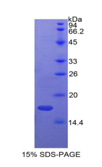 Cattle Recombinant Adrenomedullin (ADM)