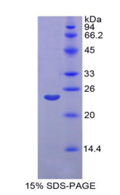 Rat Recombinant Matrix Metalloproteinase 11 (MMP11)