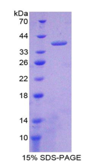 Rat Recombinant Nesfatin 1 (NES1)