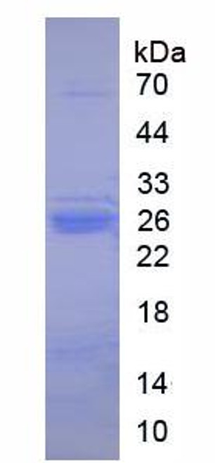 Pig Native Trypsin (TRY)