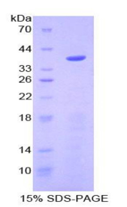 Mouse Recombinant Apolipoprotein C1 (APOC1)