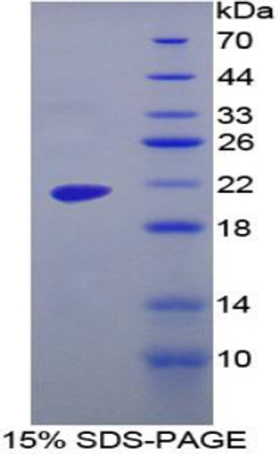 Human Recombinant Maltase Glucoamylase, Intestinal (MGA)