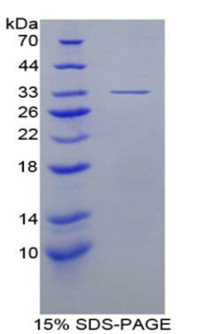 Human Recombinant Cathepsin K (CTSK)