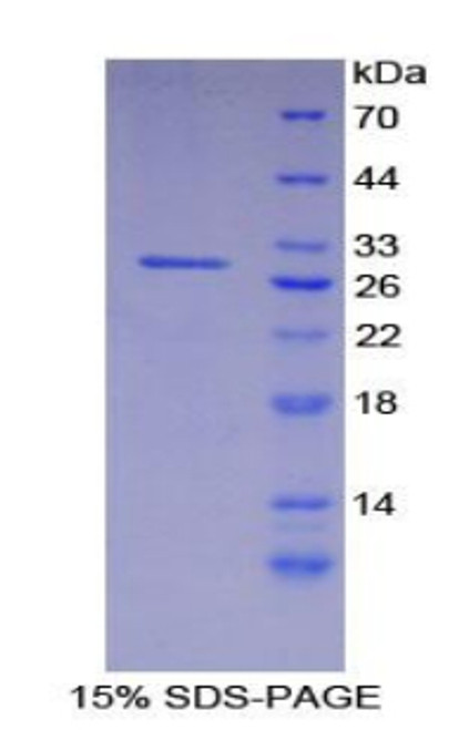 Human Recombinant Integrin Alpha D (ITGaD)