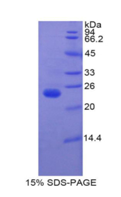 Mouse Recombinant Insulin Like Growth Factor Binding Protein 6 (IGFBP6)