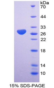 Human Recombinant Talin (TLN)