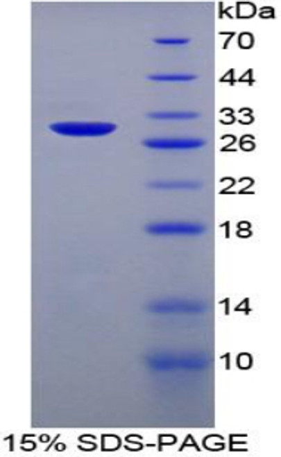 Rat Recombinant Heparin Cofactor II (HCII)