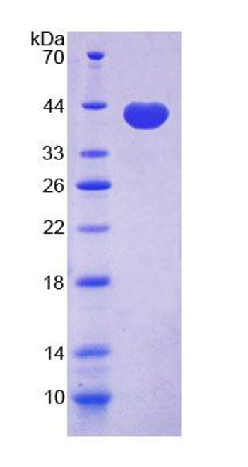 Cattle Recombinant Galectin 4 (GAL4)