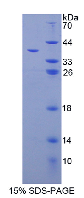 Mouse Recombinant Galectin 4 (GAL4)