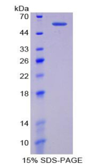 Mouse Recombinant Thyroxine Binding Globulin (TBG)