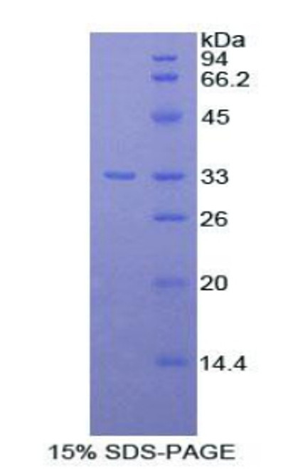 Rat Recombinant Thyroxine Binding Globulin (TBG)