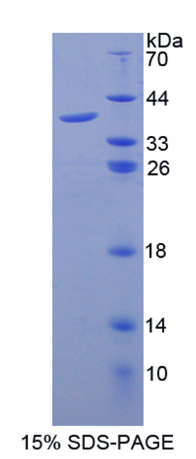 Mouse Recombinant Galectin 8 (GAL8)