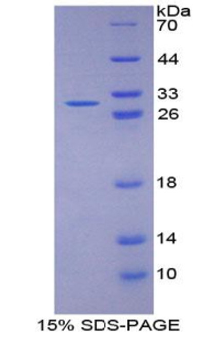 Rat Recombinant Microtubule Associated Protein 1A (MAP1A)