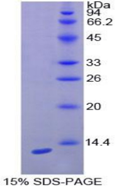 Rat Recombinant Interferon Gamma Induced Protein 10kDa (IP10)