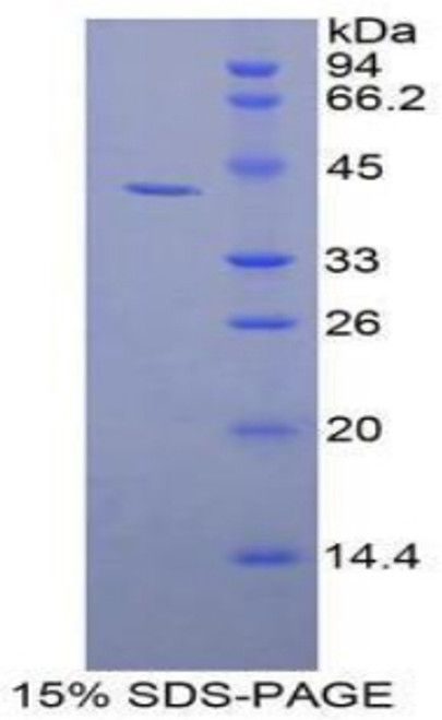 Human Recombinant Gelsolin (GS)