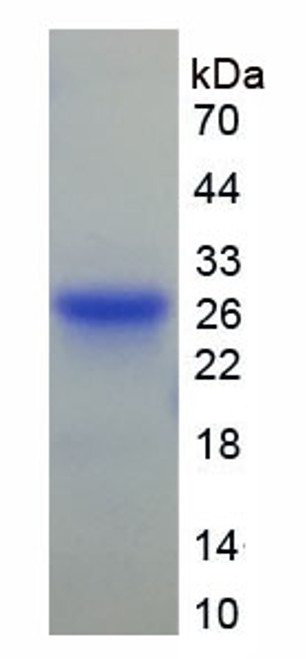 Mouse Recombinant Gelsolin (GS)