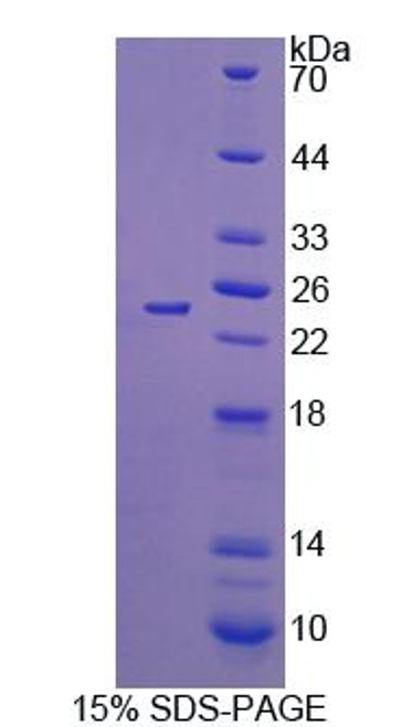 Mouse Recombinant Sex Hormone Binding Globulin (SHBG)