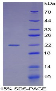 Human Recombinant High Mobility Group Protein 1 (HMG1)