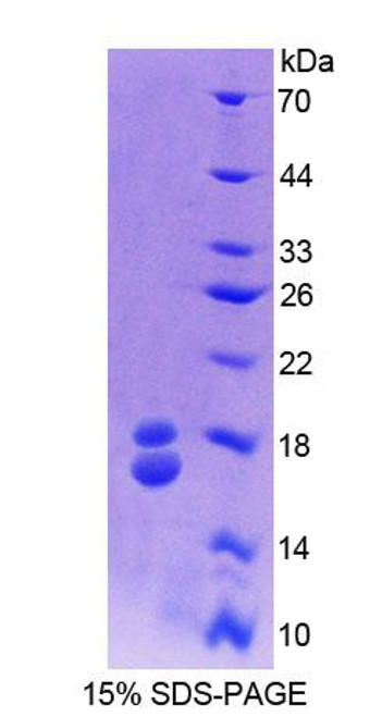 Cattle Recombinant Retinol Binding Protein 1, Cellular (RBP1)