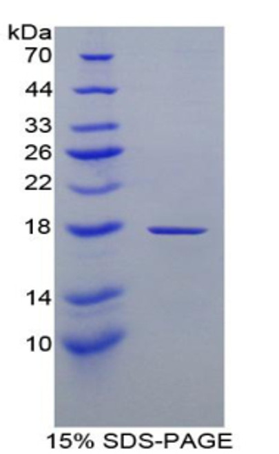 Human Recombinant Retinol Binding Protein 1, Cellular (RBP1)