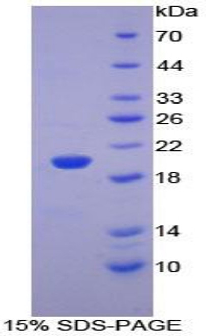 Mouse Recombinant Pleckstrin Homology Like Domain Family A, Member 2 (PHLDA2)