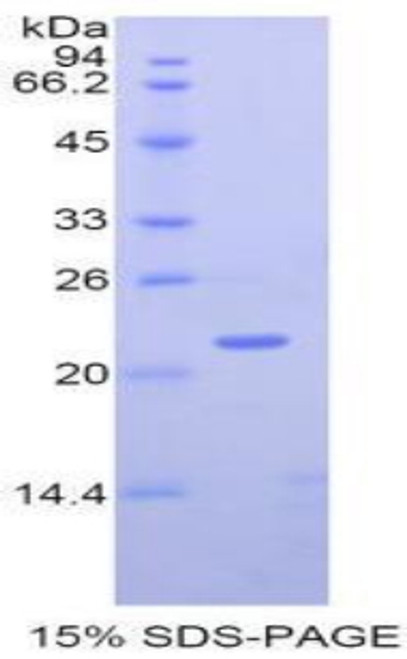 Human Recombinant Matrix Metalloproteinase 12 (MMP12)